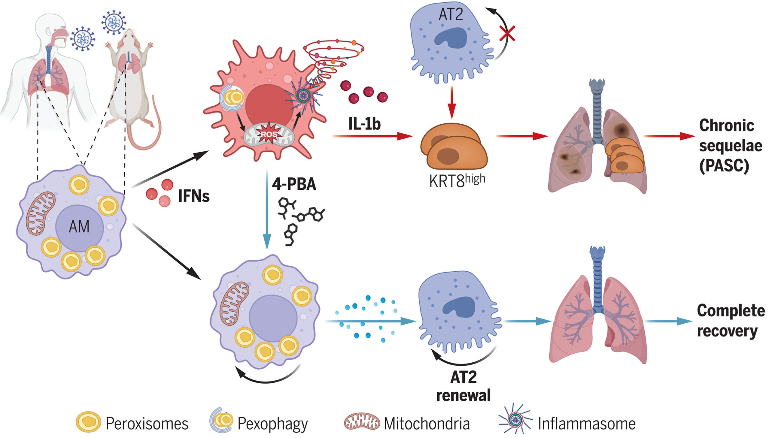 Covid-19 Discovery ouvre la porte à de nouveaux traitements pour les problèmes pulmonaires chroniques