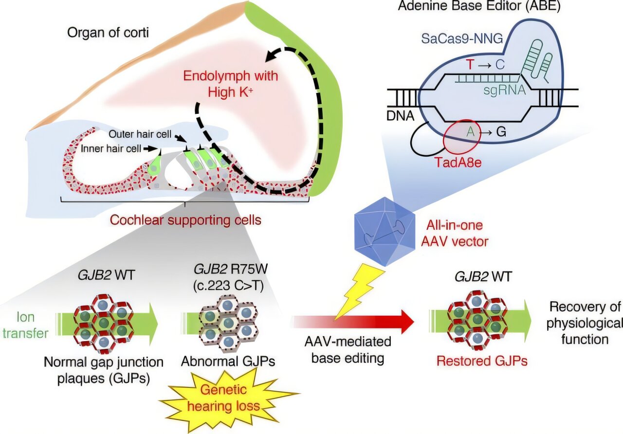 L'édition de gènes avec un vecteur de virus associé adéno offre de l'espoir pour la surdité héréditaire