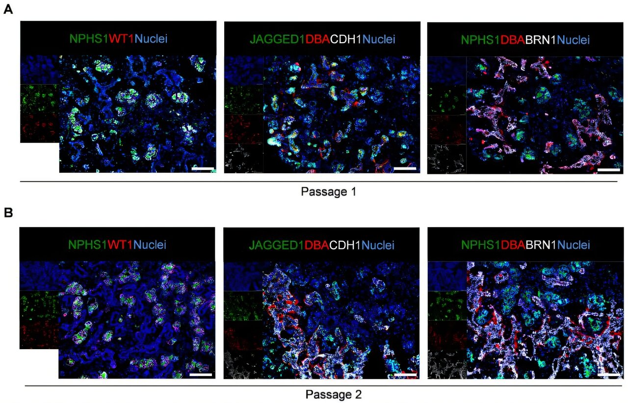 Une nouvelle façon de développer les cellules progénitrices rénales dérivées de cellules IPS peut conduire à des thérapies régénératives rénales