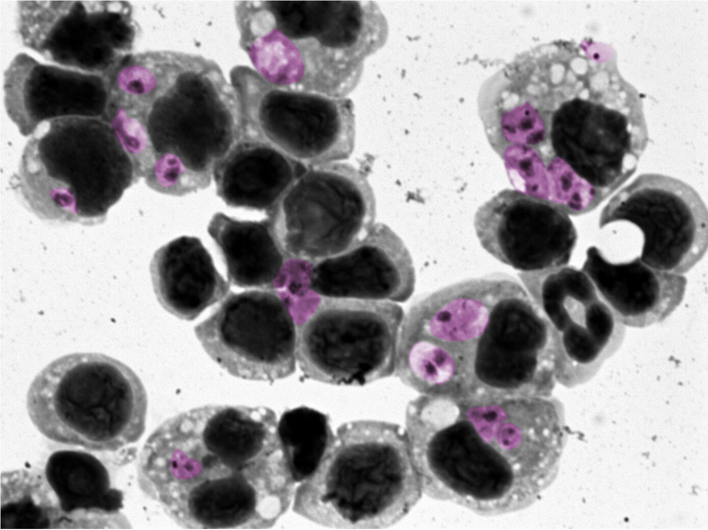 Les biomarqueurs aident à prédire le succès du traitement des maladies de la peau parasite