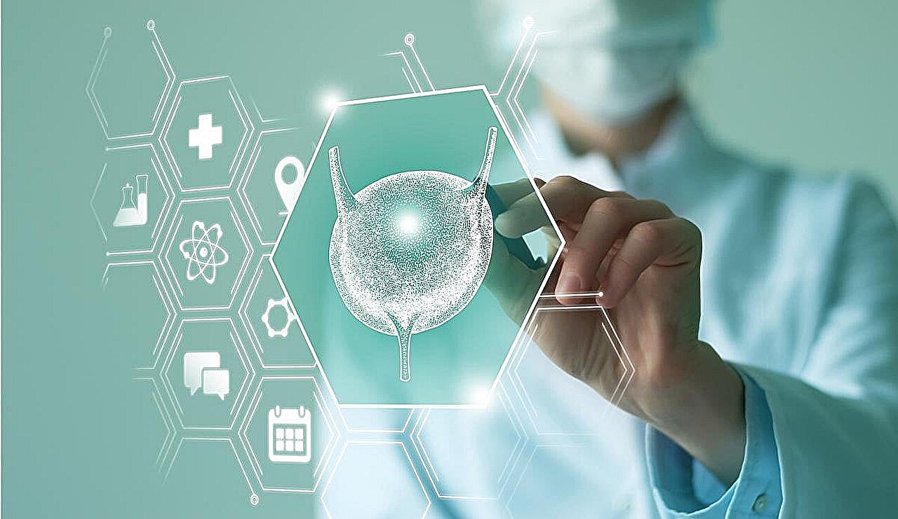 L'indice de risque nutritionnel gériatrique est prédictif de la vessie hyperactive chez les personnes âgées