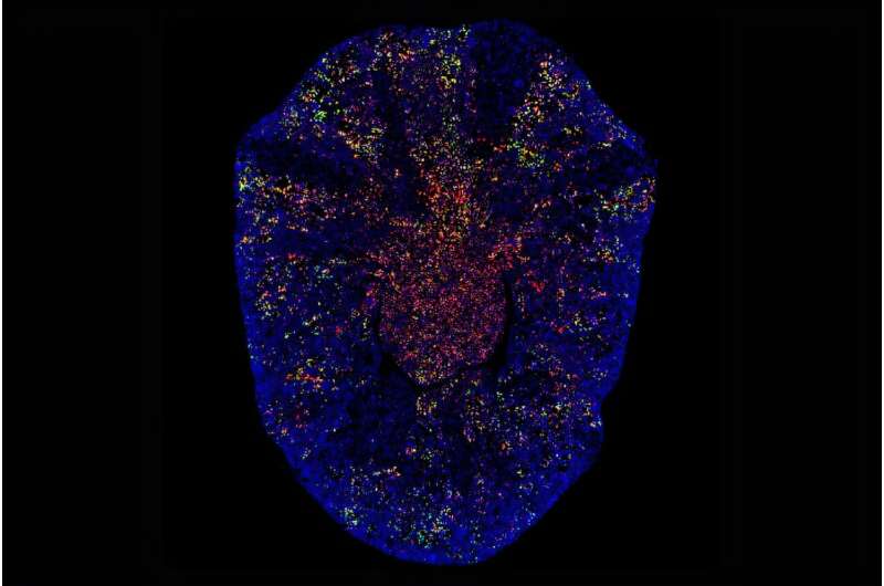 Les chercheurs de l'UCLA identifient une approche de médecine de précision pour prévenir l'insuffisance rénale
