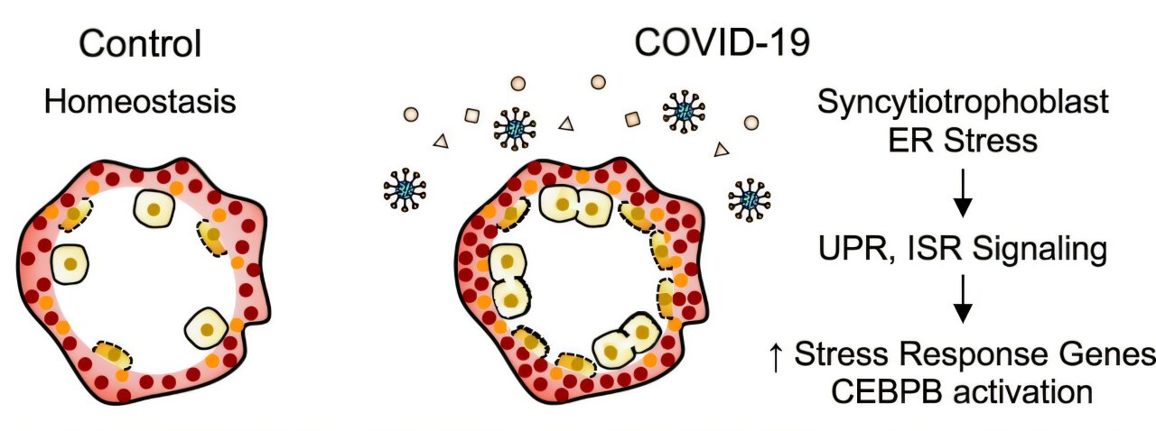 La réponse au stress du placenta humain à l'infection maternelle Covid-19 renforce la barrière fœtale maternelle