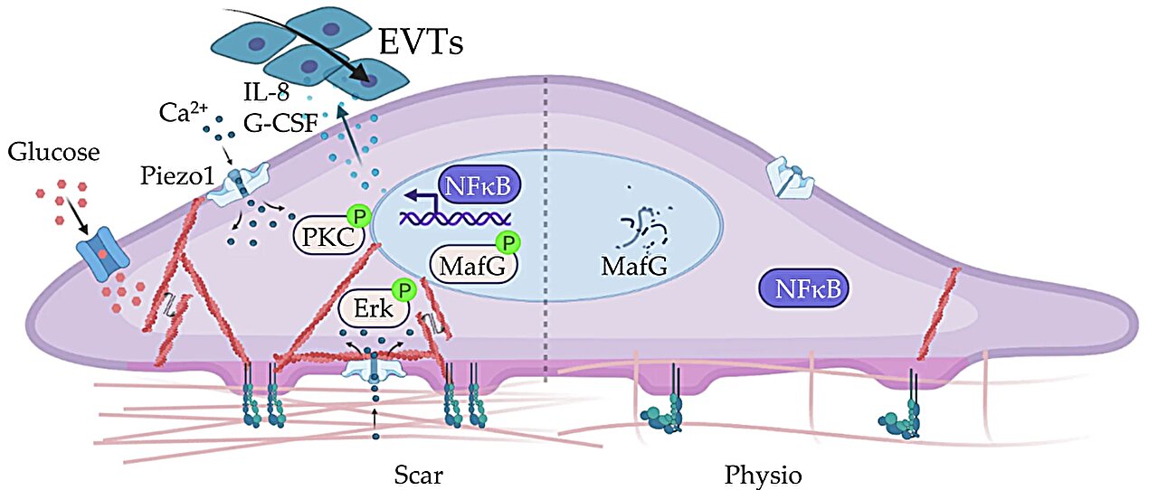 L'étude Placenta Acreta trouve l'inflammation du collagène de cicatrice et attire les cellules placentaires invasives