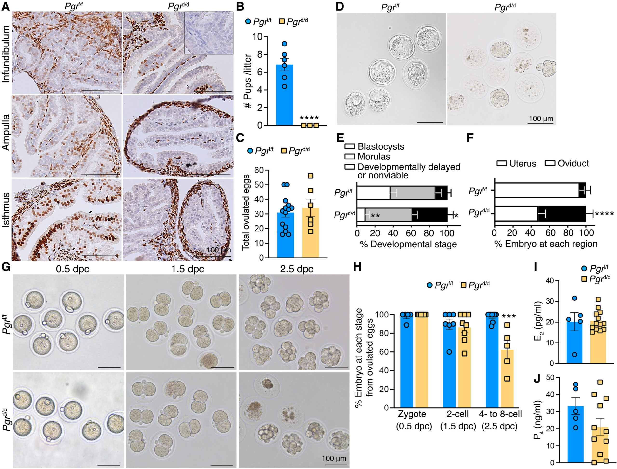 Inflammation dans les voies de reproduction liées à l'infertilité, l'hormonothérapie peut aider