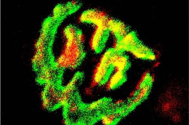 Cette image illustre comment l'inhibition pharmacologique du glutamate déshydrogénase 1 (GLUD1) restaure la morphologie de la jonction neuromusculaire des souris MDX, un modèle de souris couramment utilisé pour la recherche DMD. Crédit: l'American Journal of Pathology / Pereira-Nunes et al.) L'étude révolutionnaire offre une nouvelle approche pour améliorer la fonction neuromusculaire chez les patients atteints de dystrophie musculaire de Duchenne