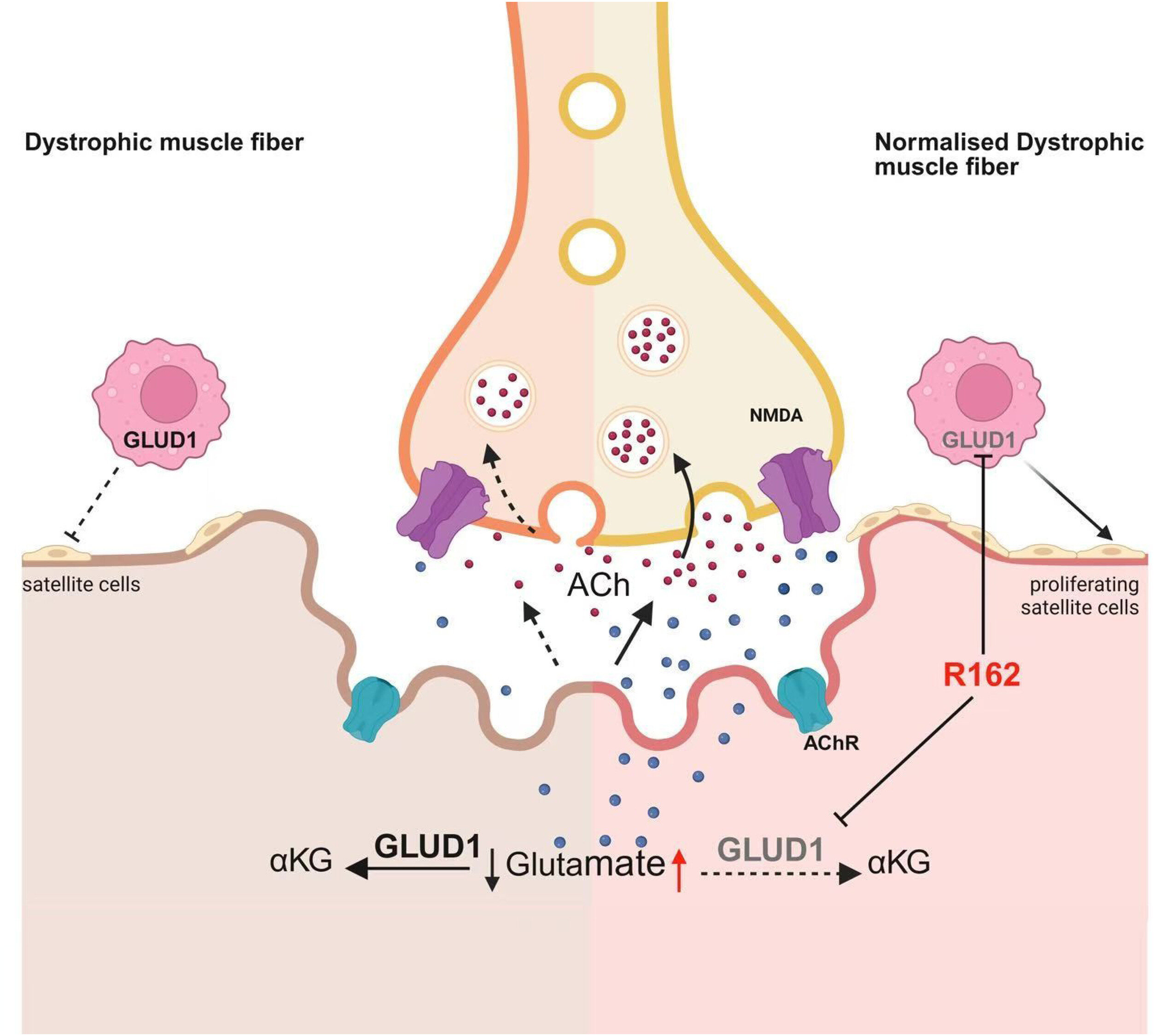Une nouvelle approche améliore la fonction neuromusculaire chez les patients atteints de dystrophie musculaire de Duchenne