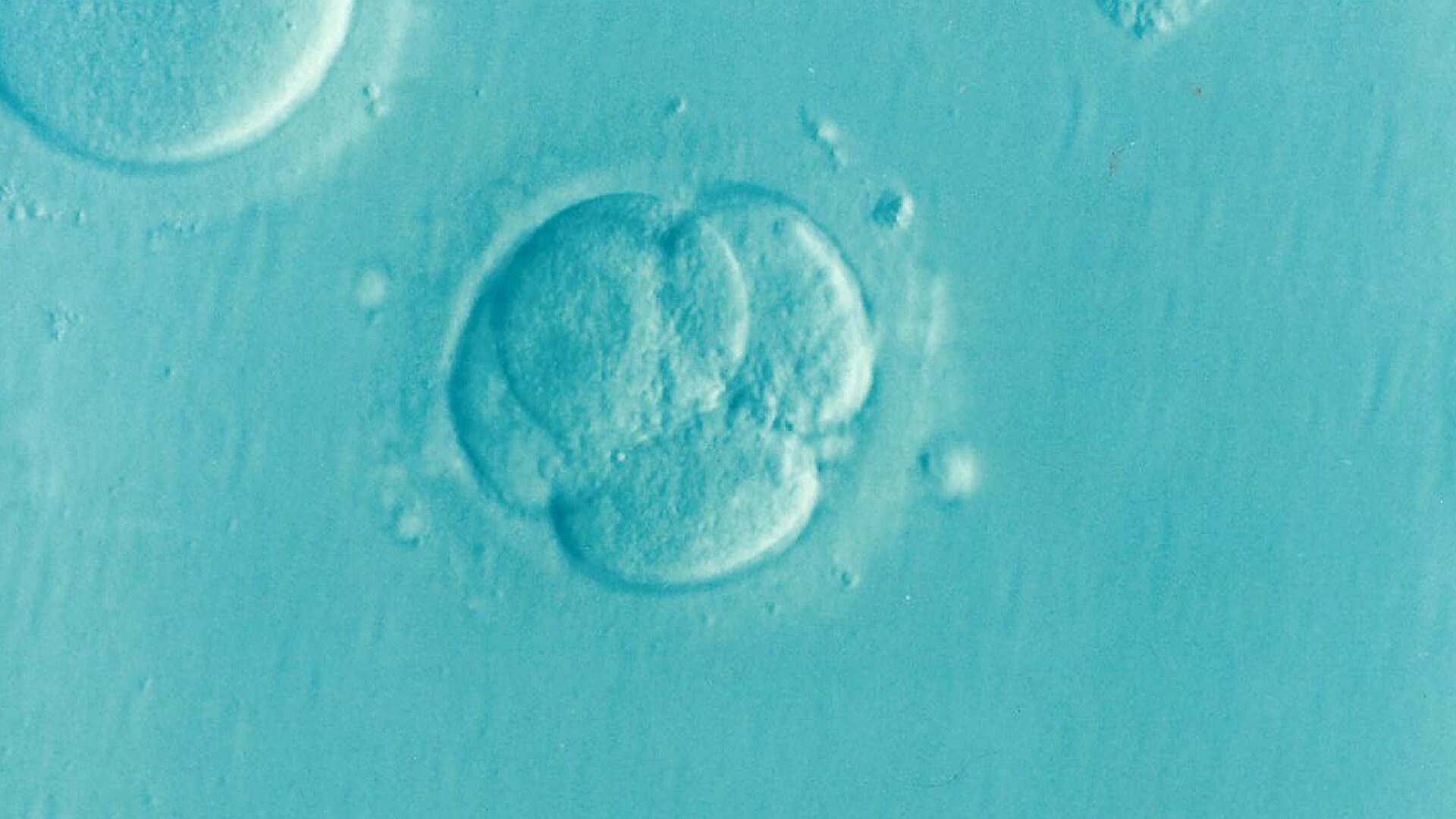 Huit bébés nés après un traitement de don mitochondrial pour réduire la transmission de la maladie de l'ADN mitochondrial