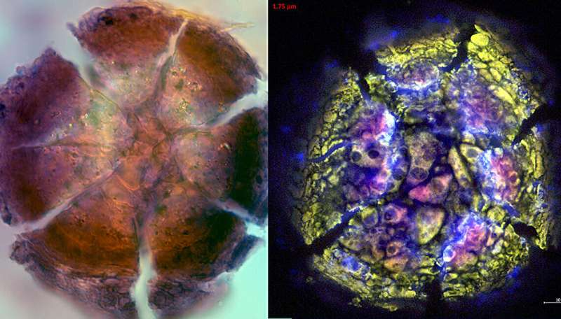 Chacun des 12 modes d'analyse a fourni des informations différentes sur la structure, la composition et la formation des calcifications, ajoutant à une image holistique. Cet échantillon de DCIS a montré des caractéristiques similaires à celles du bois pétrifié, révélant des changements dans la physiologie des tissus à mesure que le cancer progressait. Crédit: Mayandi Sivaguru L'étude trouve des différences entre les calcifications bénignes et cancer du sein - Bureau des nouvelles