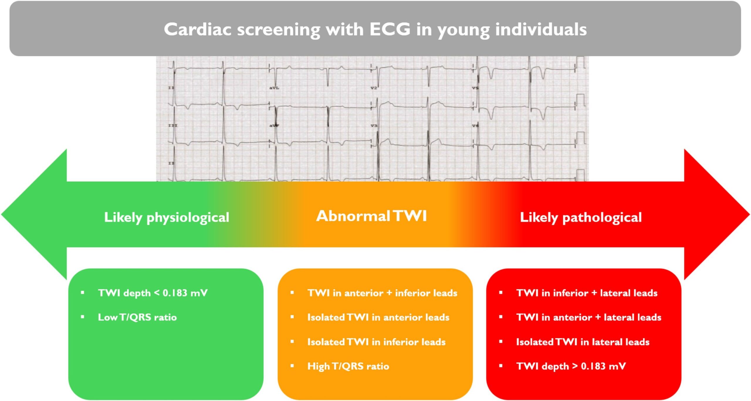 De nouveaux indices du test de rythme cardiaque pourraient empêcher une mort subite chez les moins de 35 ans