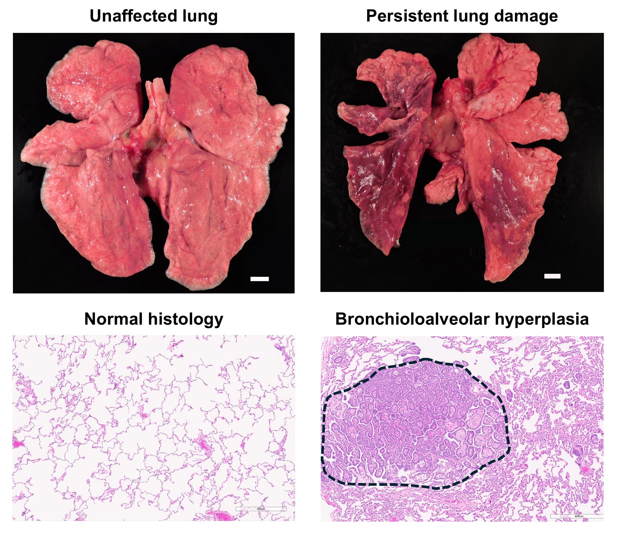L'obésité modifie les effets à long terme de Covid-19 dans l'étude des primates