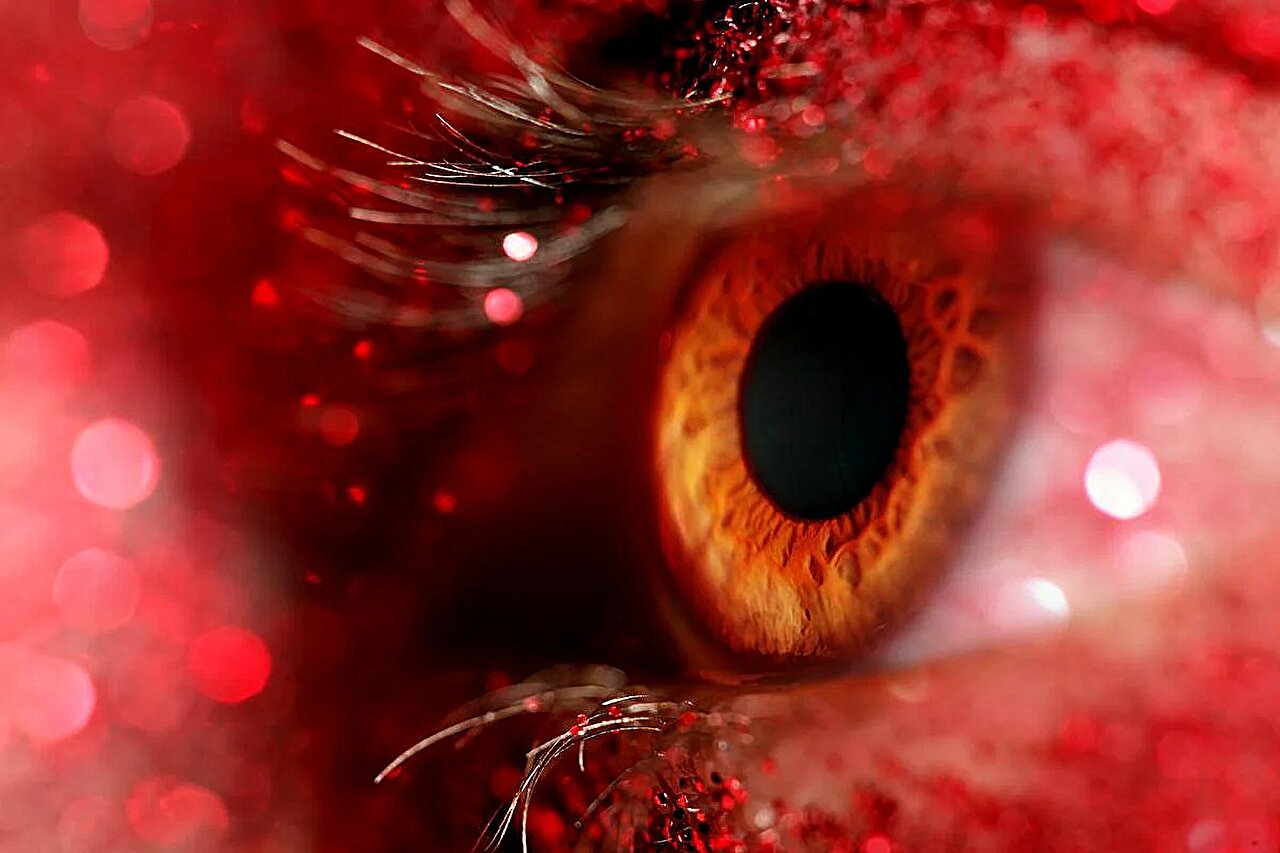 Corticostéroïdes non supérieurs au placebo pour le traitement complémentaire de la kératite bactérienne