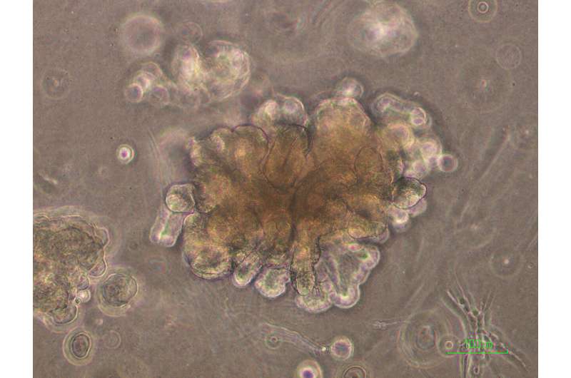 Les chercheurs ont cultivé des organoïdes rénaux humains des cellules souches tissulaires, reflétant le développement des reins fœtaux en laboratoire au fil des mois