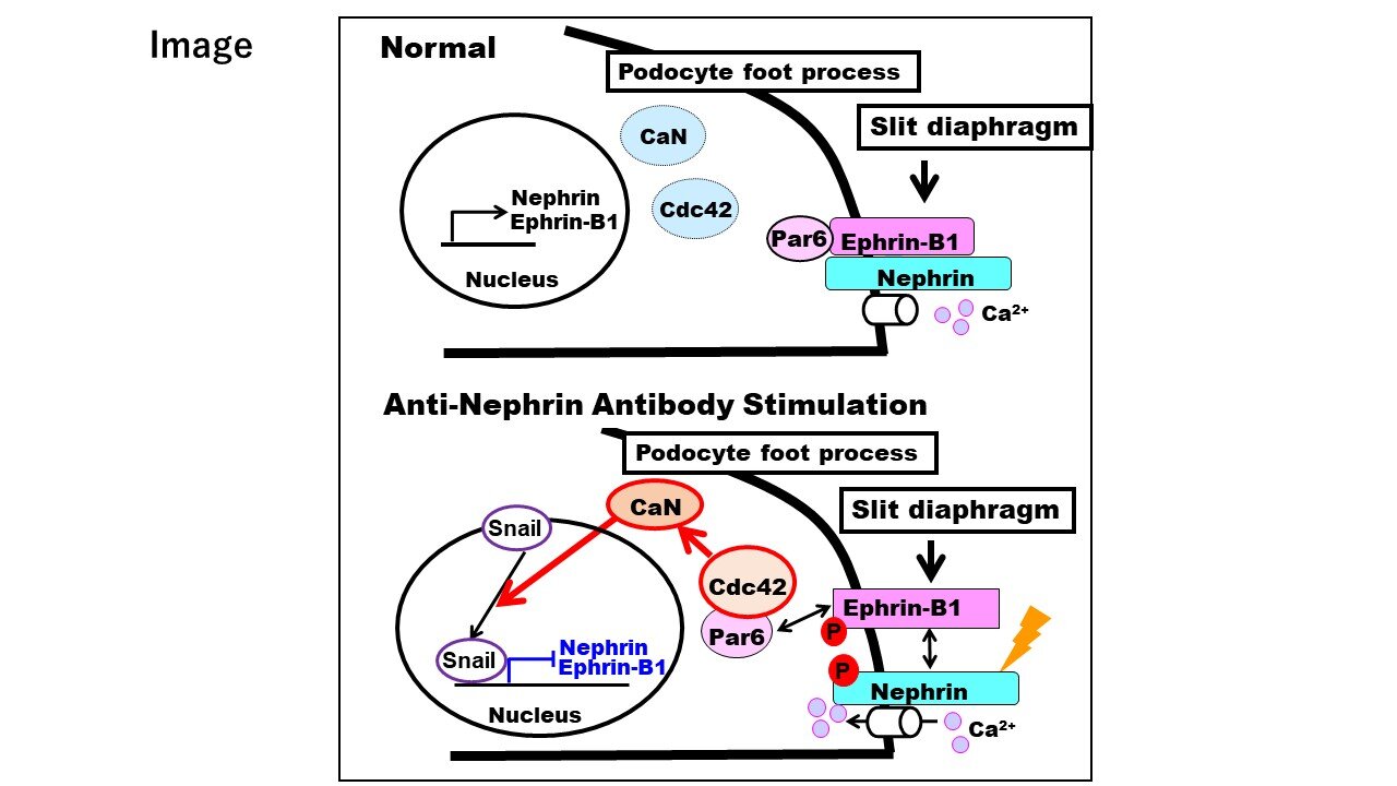 L'activité élevée du CDC42 est un événement d'initiation clé conduisant à la protéinurie, révèle la recherche