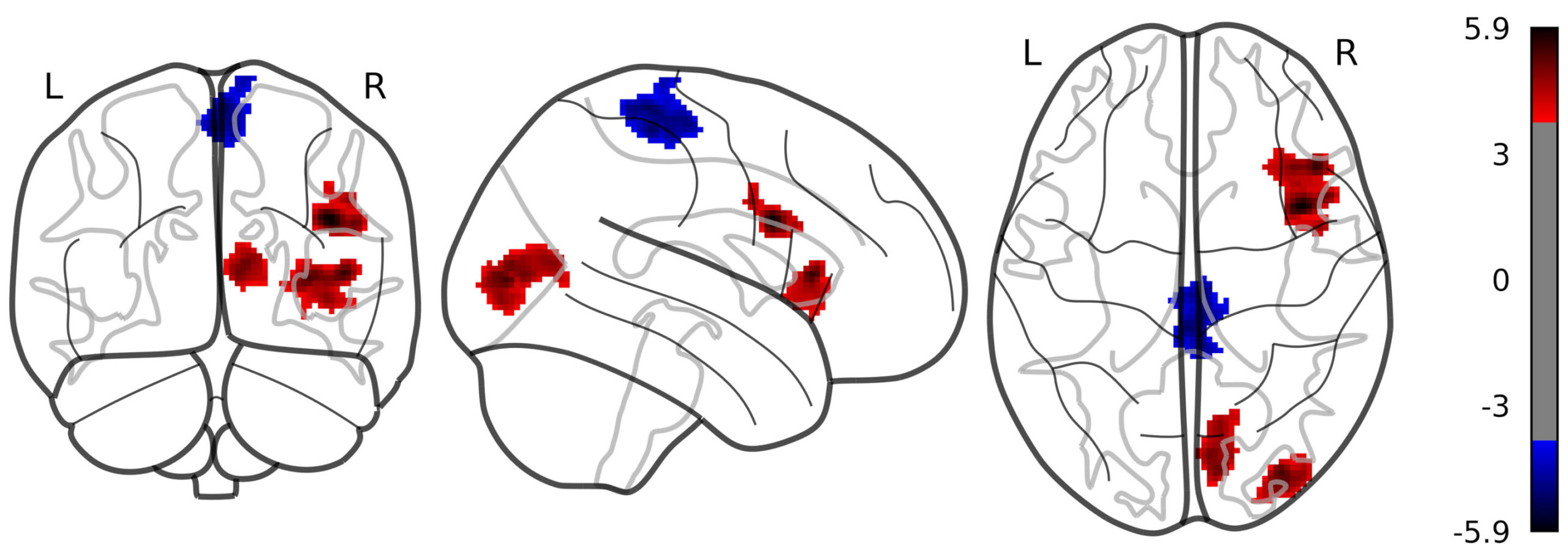 Nouvelle voie neuronale pour traiter les troubles de la consommation d'alcool identifiés