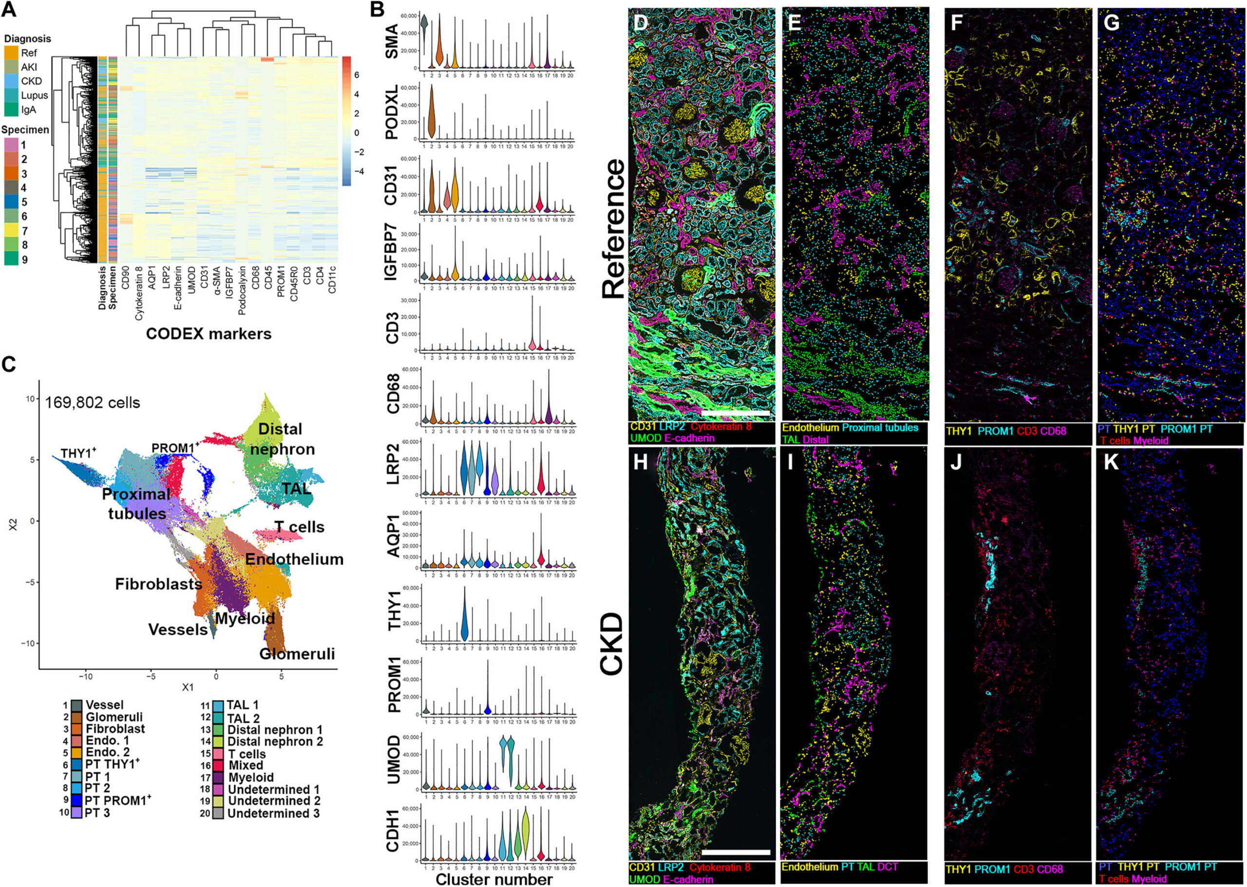 Les types de cellules rénales nouvellement classées peuvent conduire à un meilleur traitement de la maladie