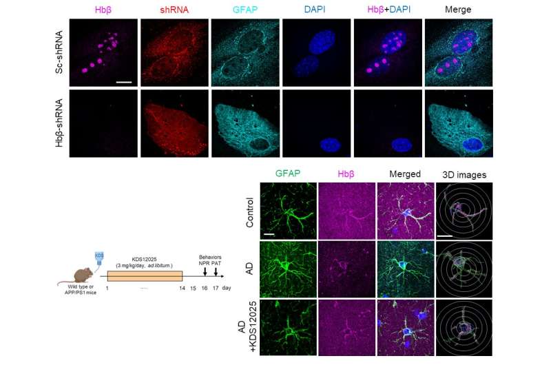 Hémoglobine repensée: une percée dans le traitement des maladies cérébrales