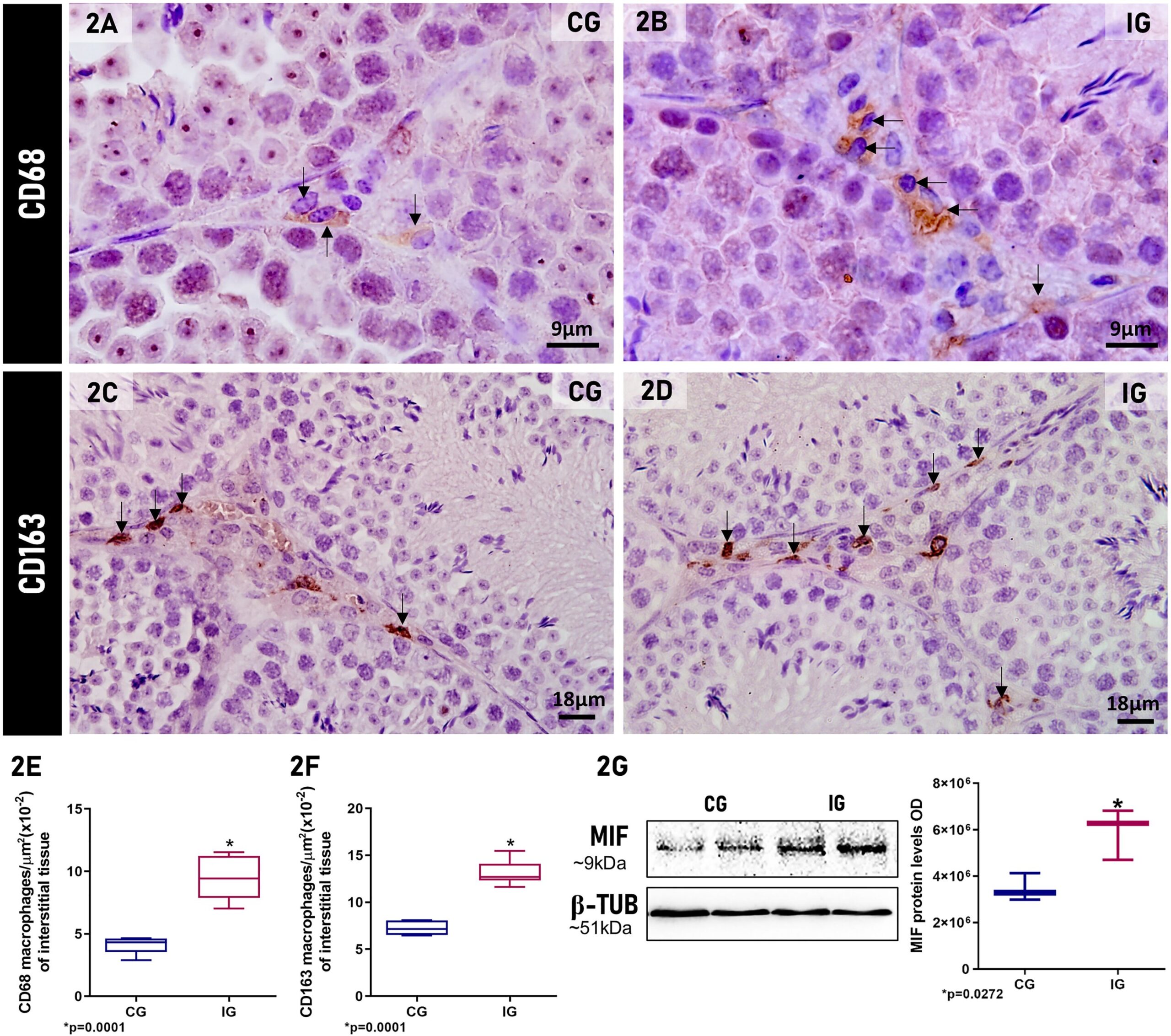 SARS-COV-2 infecte les cellules testiculaires et utilise des machines cellulaires pour se reproduire, les résultats de l'étude