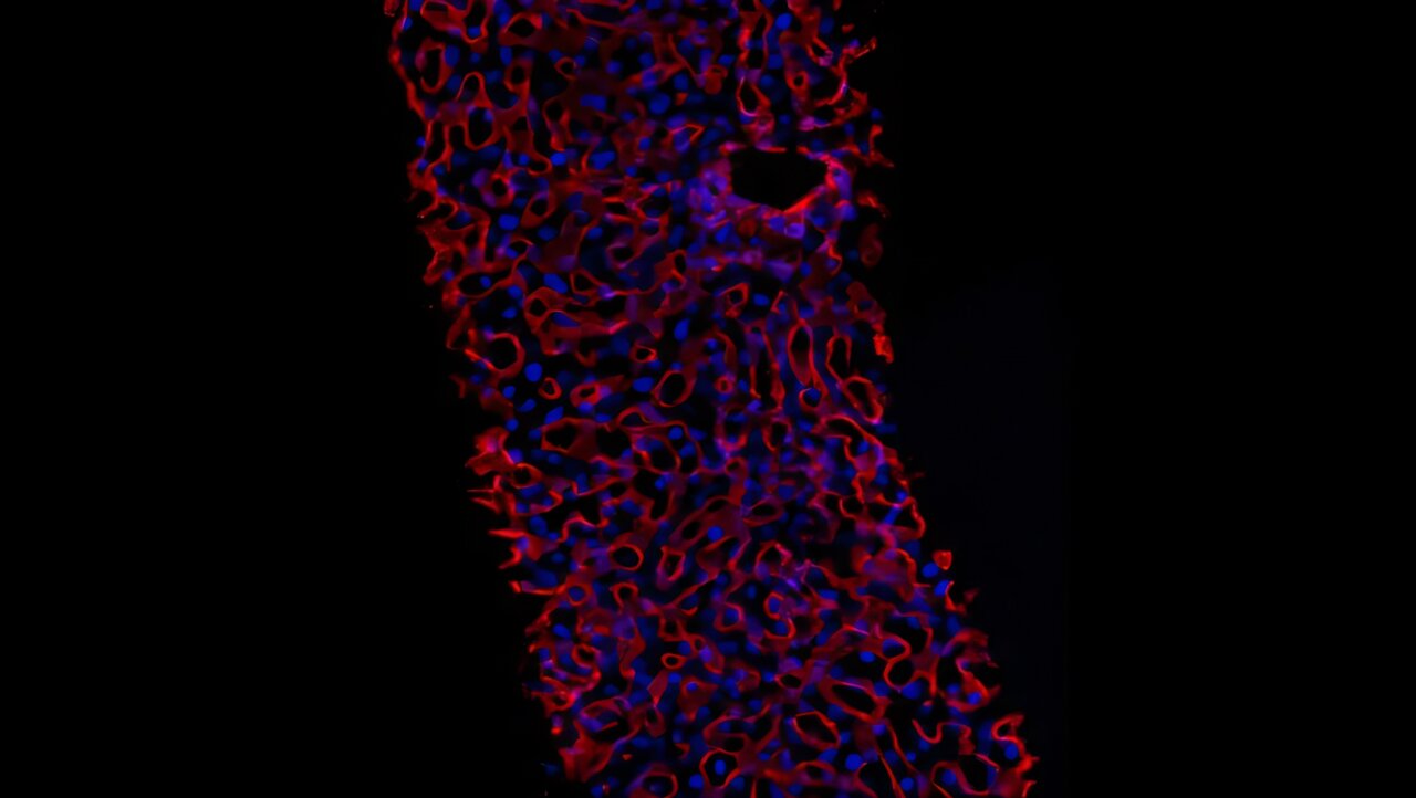 La drogue remodèle l'architecture tissulaire pour réduire les dommages aux maladies hépatiques liées à l'alcool