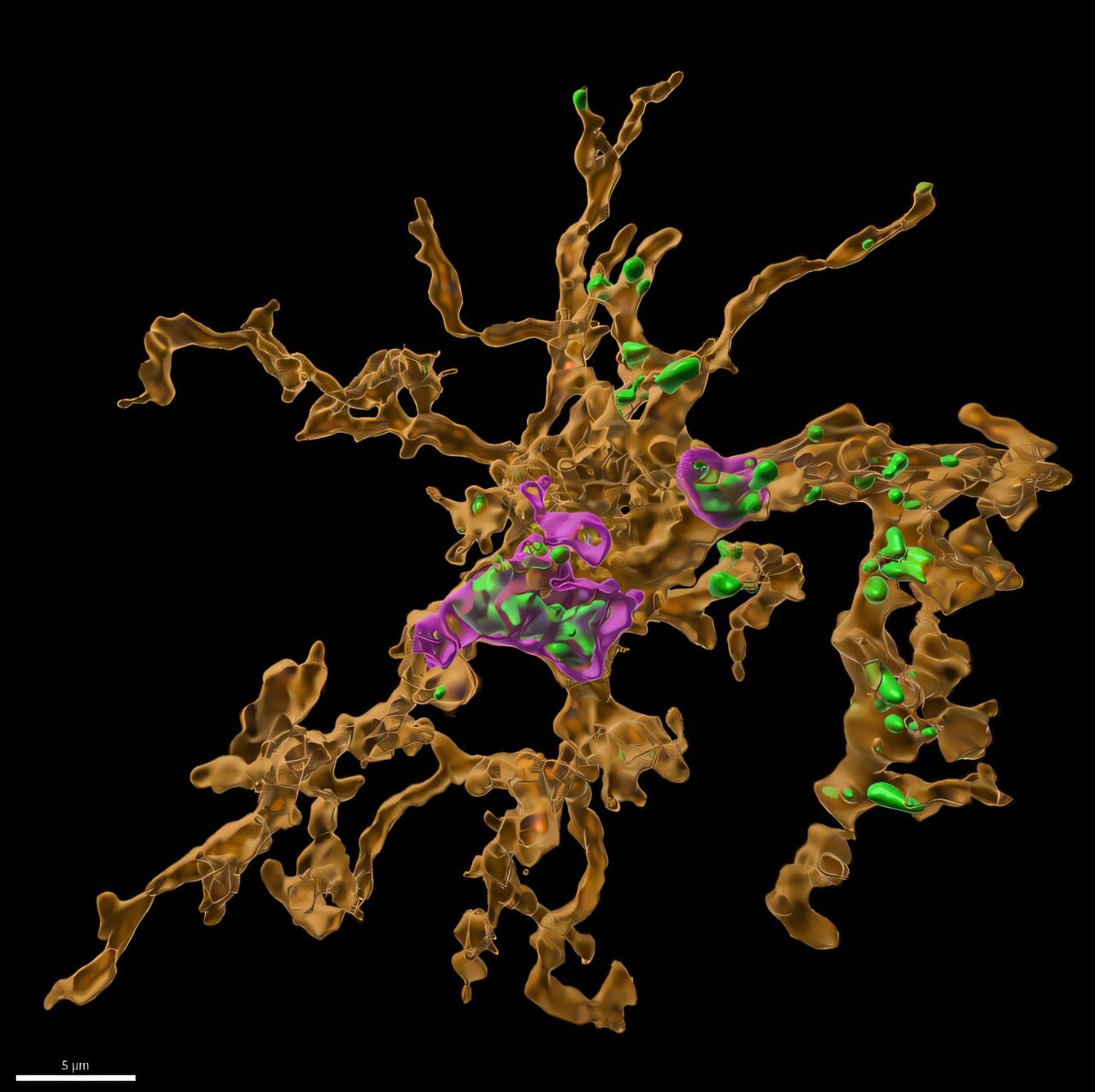 Comment le système immunitaire du cerveau entraîne une rechute de médicament et une nouvelle façon potentielle de l'arrêter