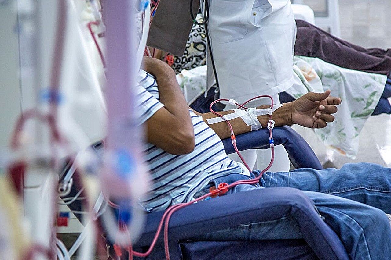 La spironolactone ne réduit pas le risque de morbidité cardiovasculaire, la mortalité chez les patients sous dialyse