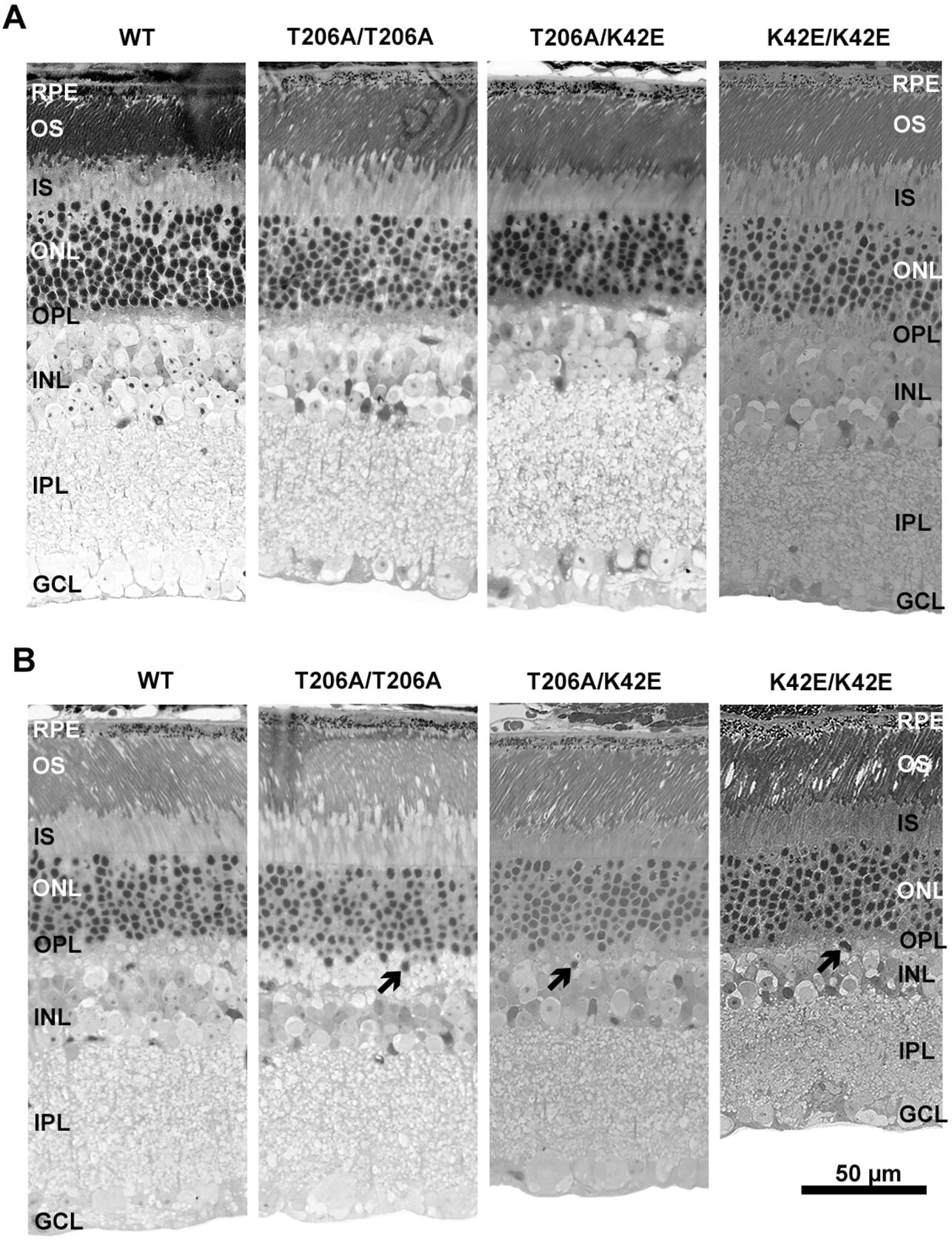 Les modèles de souris de la rétinite pigmentosa reflètent la pathobiologie du RP59 humain