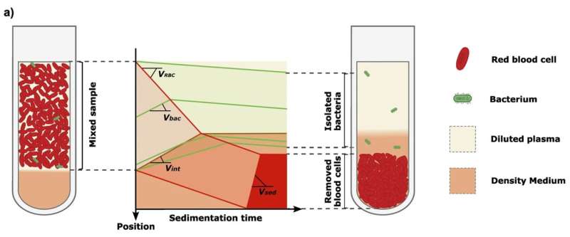Le nouveau diagnostic de septicémie pourrait réduire le temps critique pour sauver les patients