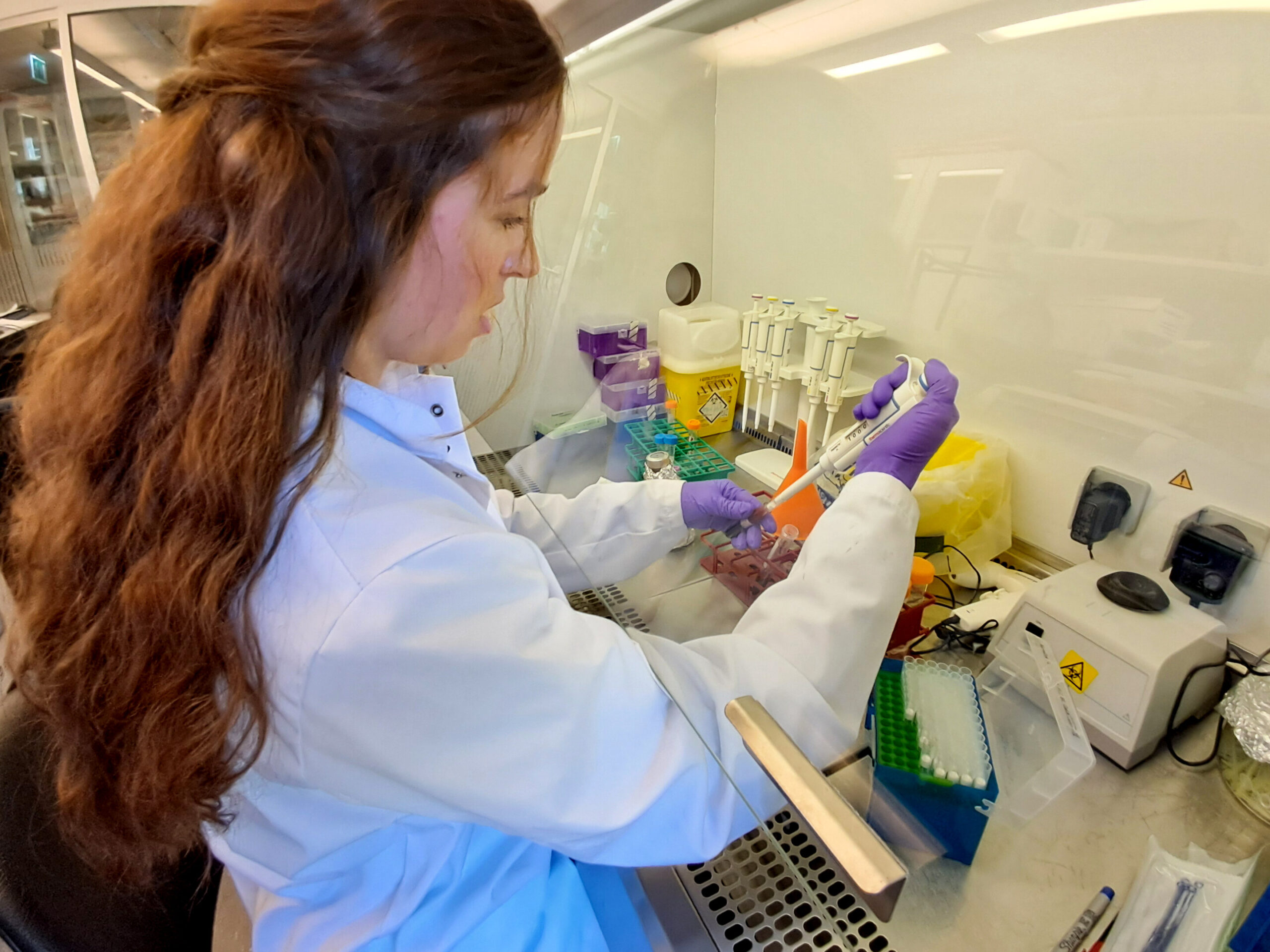 La méthode de diagnostic plus rapide peut détecter la septicémie en heures au lieu de jours