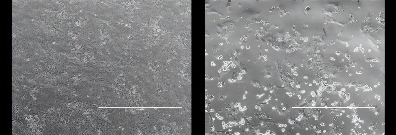 Le virus nouvellement découvert dans les chauves-souris aide à renforcer les défenses de l'Australie contre les maladies infectieuses émergentes