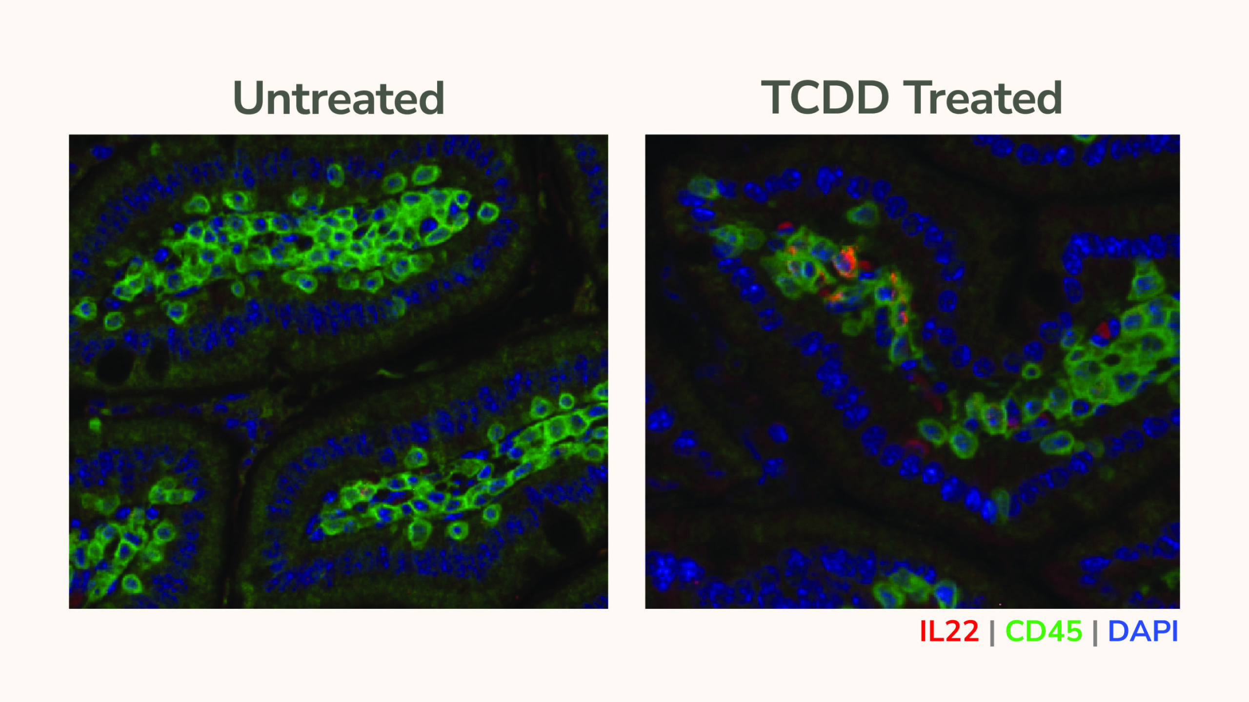 L'étude montre comment le tabagisme entraîne un cancer du pancréas