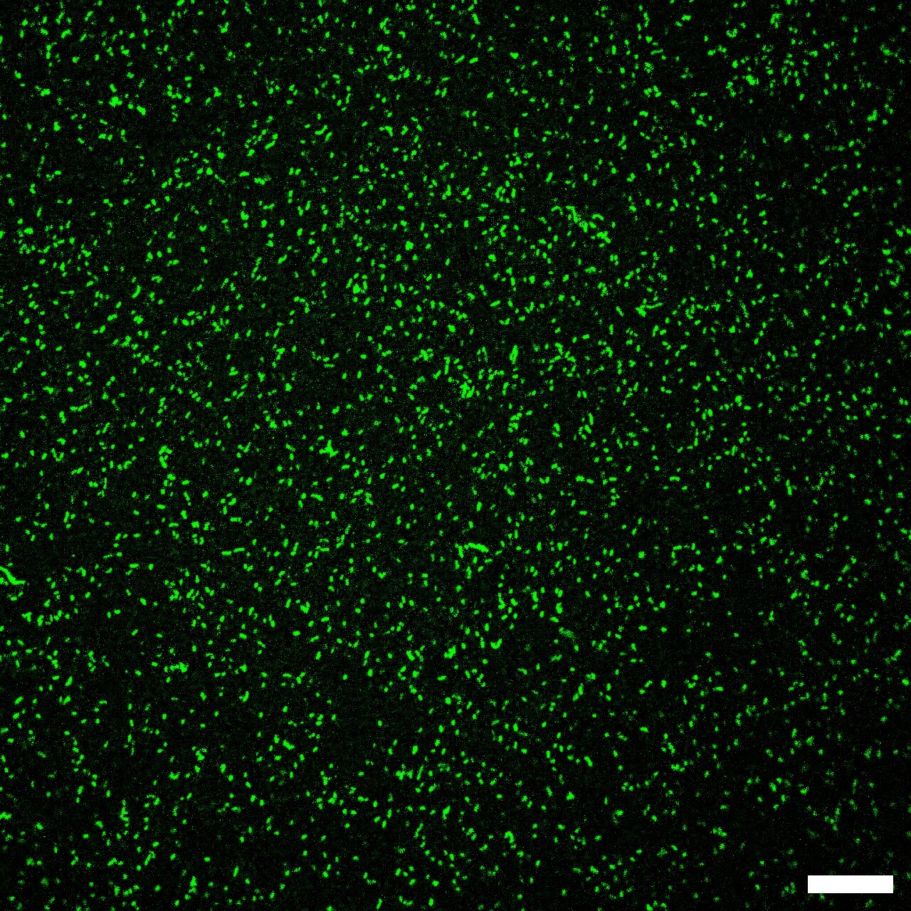 Dés-mystifiant une idée fausse commune sur la prévalence des bactéries de Legionella