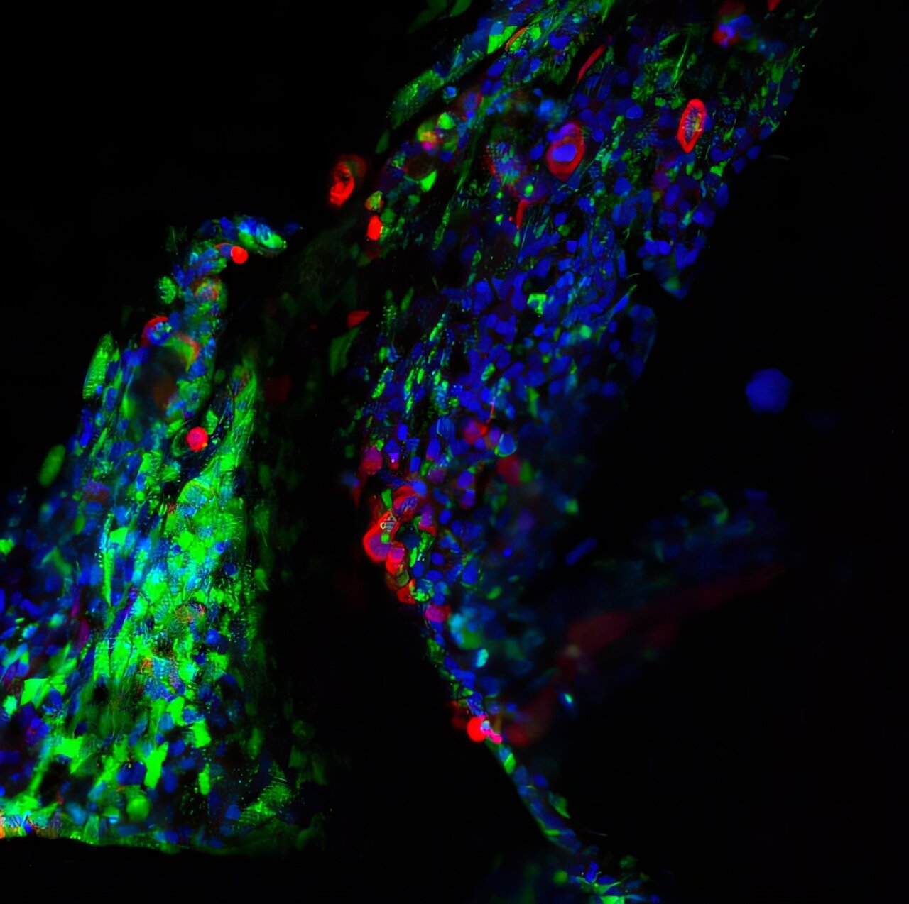 Les protéines humaines clés qui alimentent la réplication du coronavirus pointent vers de nouvelles stratégies de traitement