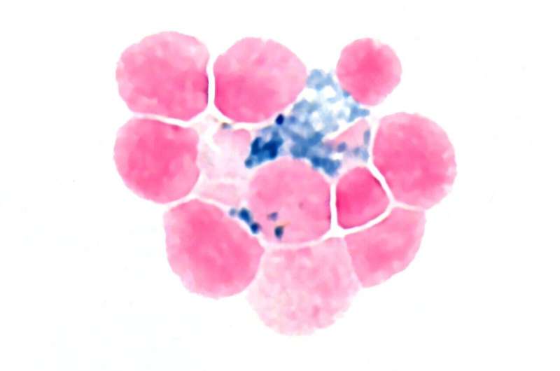 De nouvelles recherches de l'Université de Princeton découvrent pourquoi les métastases osseuses conduisent souvent à l'anémie