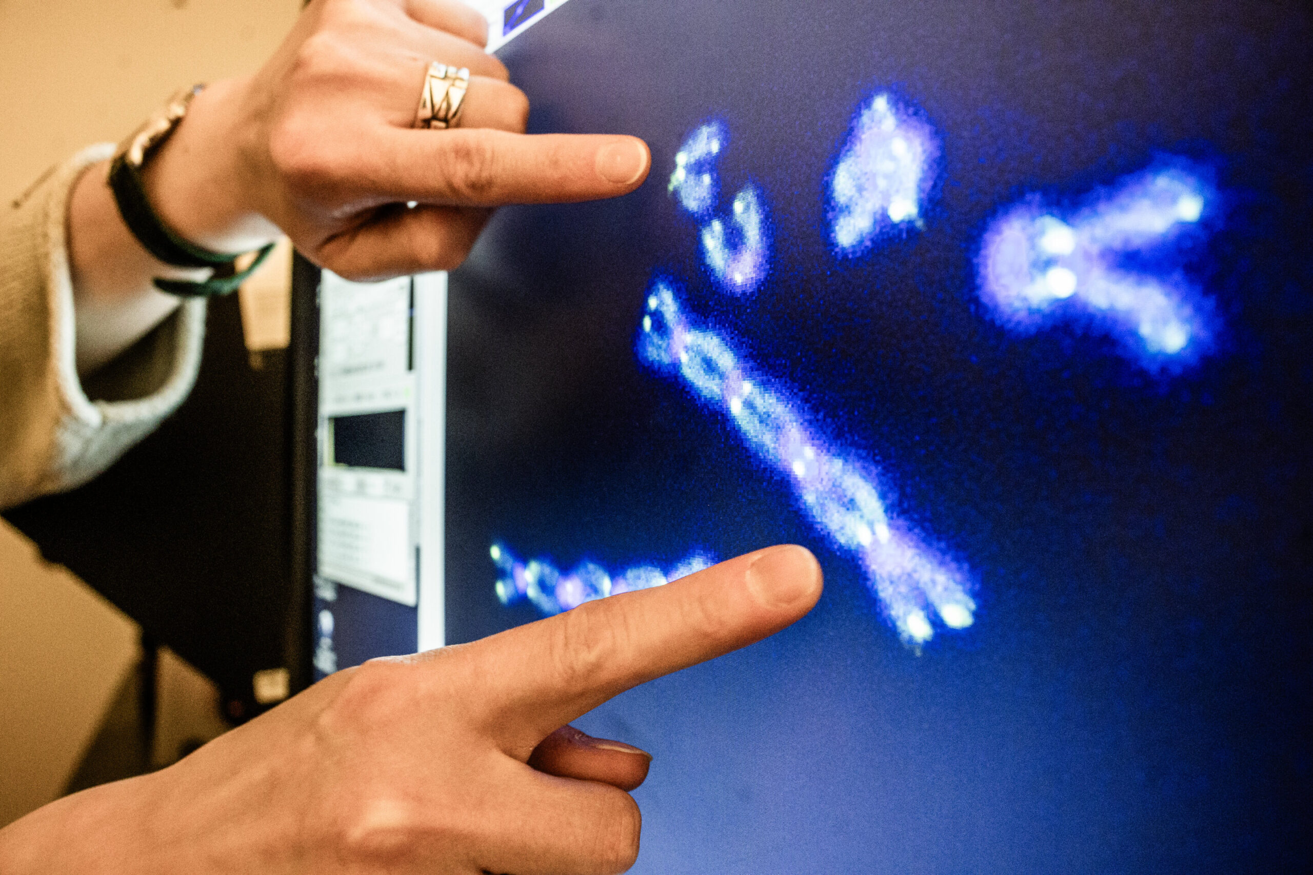 La découverte révèle comment les extrémités chromosomiques peuvent être protégées