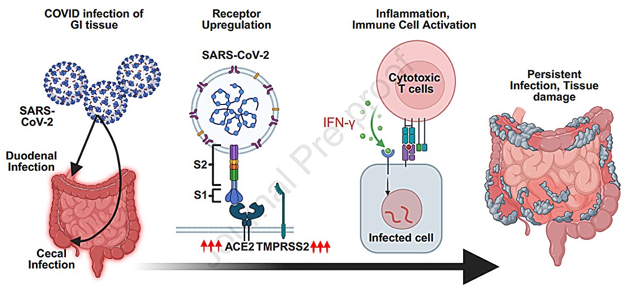 Les chercheurs découvrent comment Covid-19 peut s'attarder chez les patients atteints de cancer et affecter les résultats du traitement