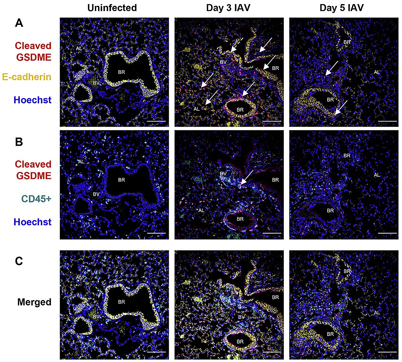 Désactiver le «bouton d'auto-destruction» qui provoque des dommages pulmonaires à la grippe