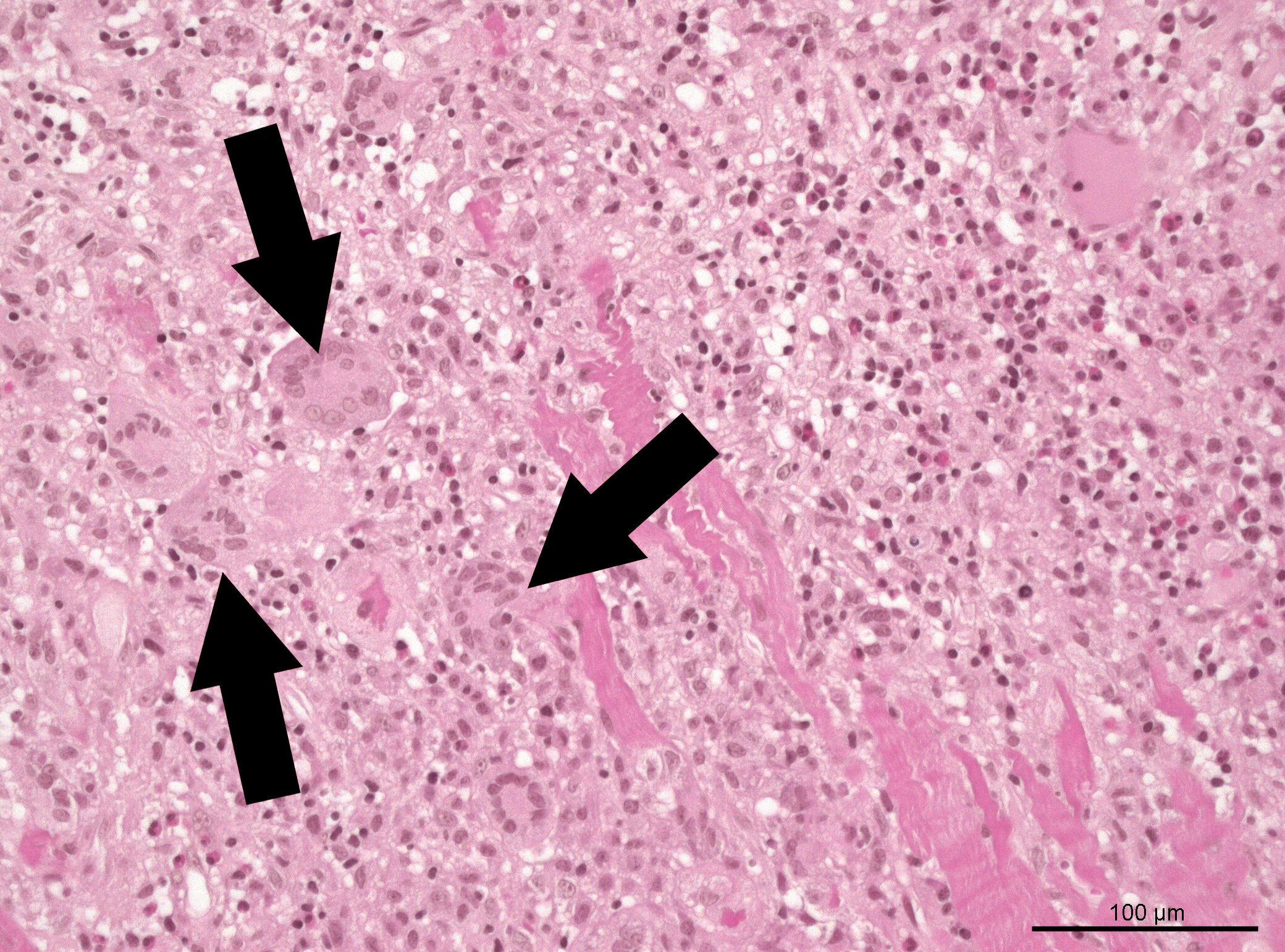 Détecter et traiter les muscles cardiaques malades aussi efficacement que possible