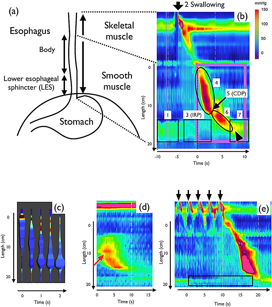 Le modèle mathématique recrée des mouvements musculaires pour expliquer les troubles de la déglutition