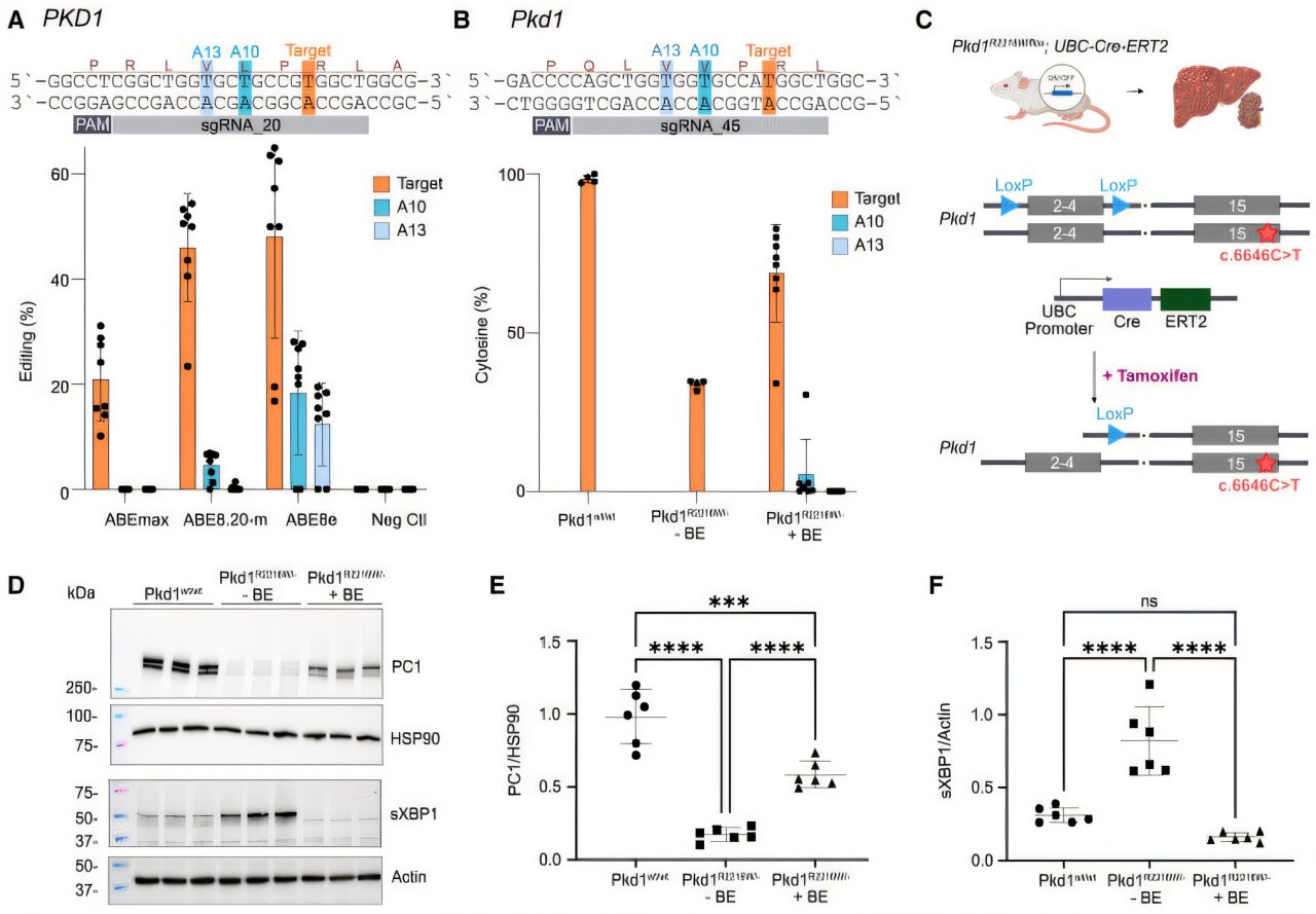 L'édition de gènes peut représenter une nouvelle façon de traiter une maladie rénale héréditaire