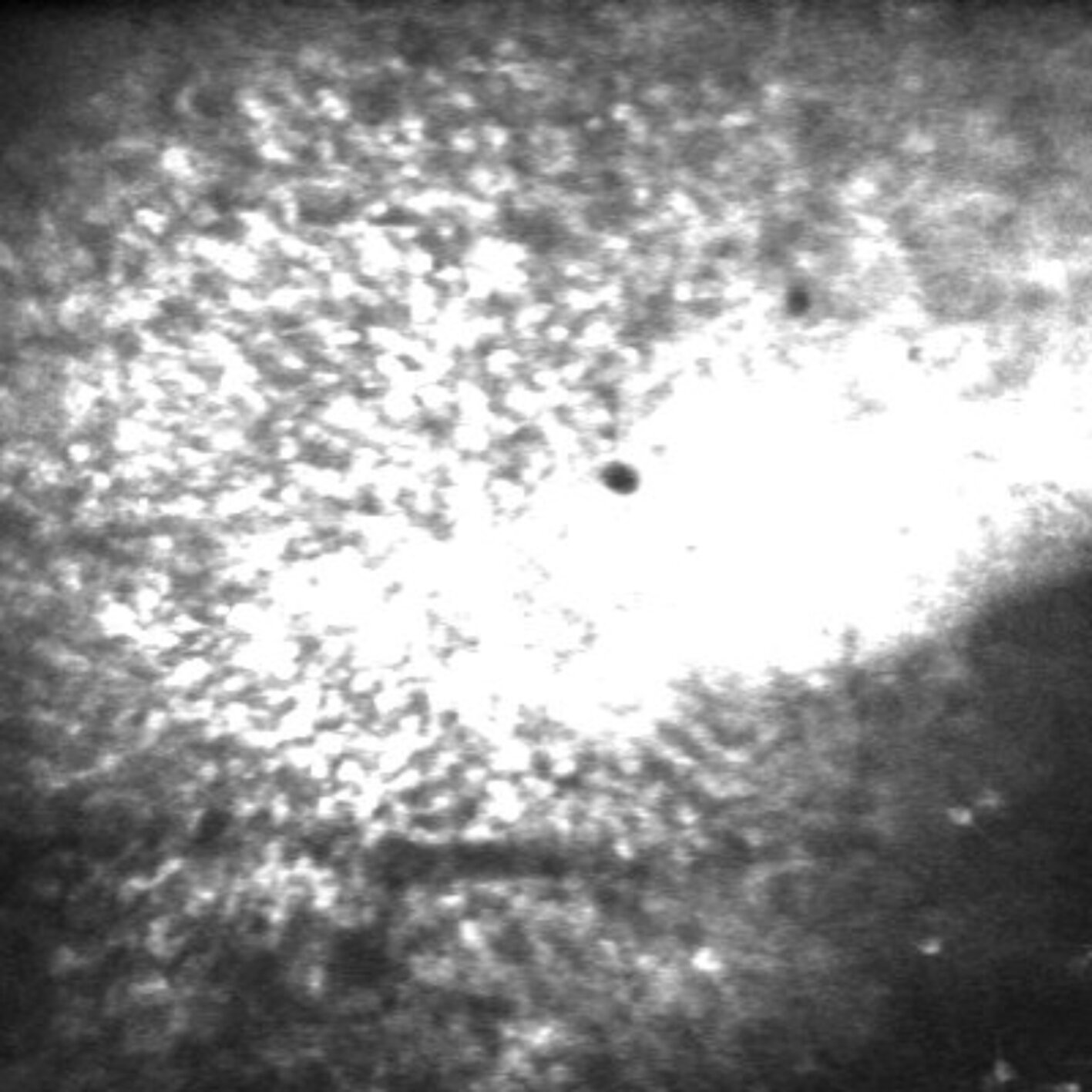 Les ondes cérébrales cachées peuvent servir de déclencheurs pour l'errance post-Seizure