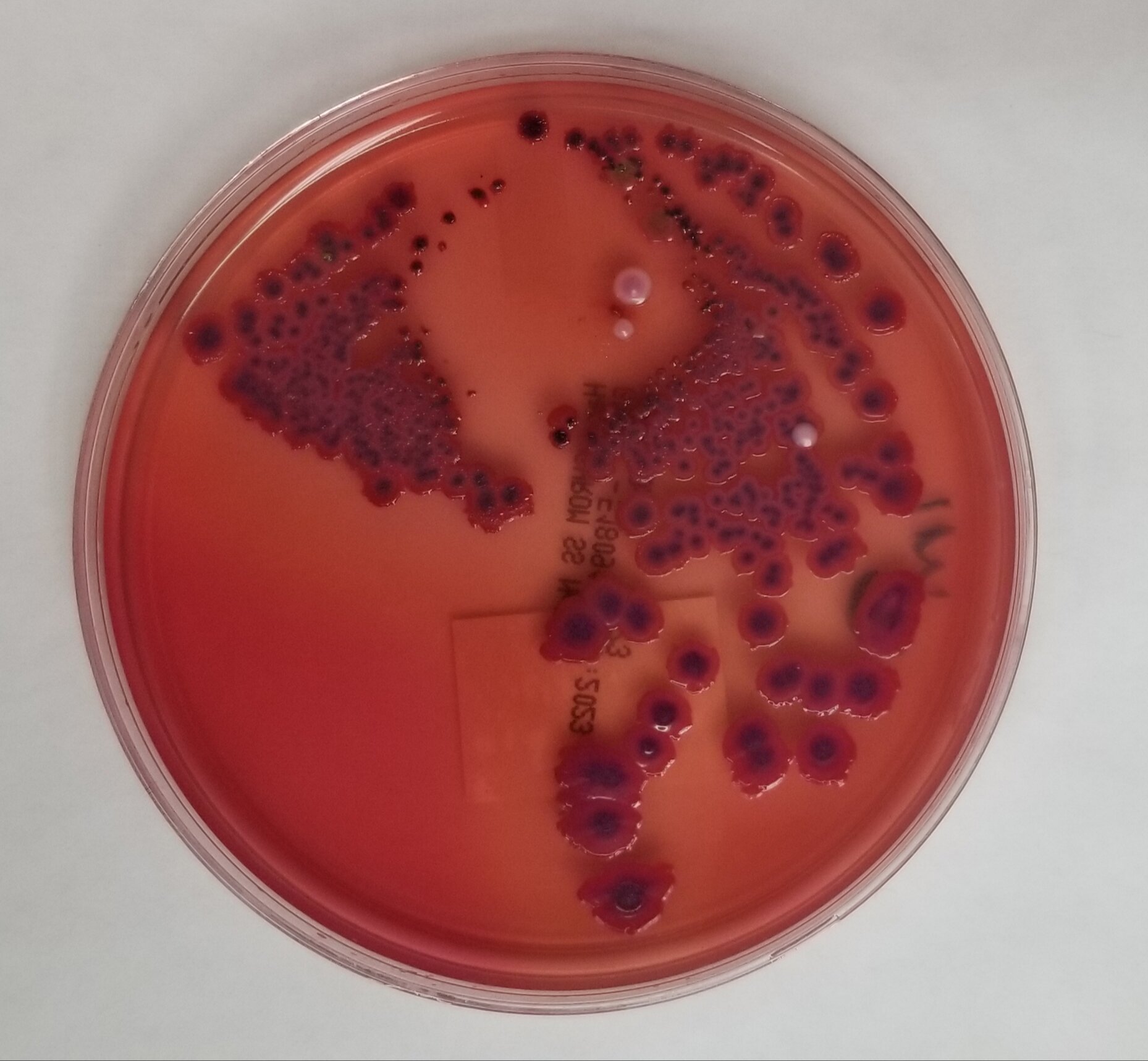 Les infections intestinales souvent négligées chez les hommes qui ont des relations sexuelles avec des hommes