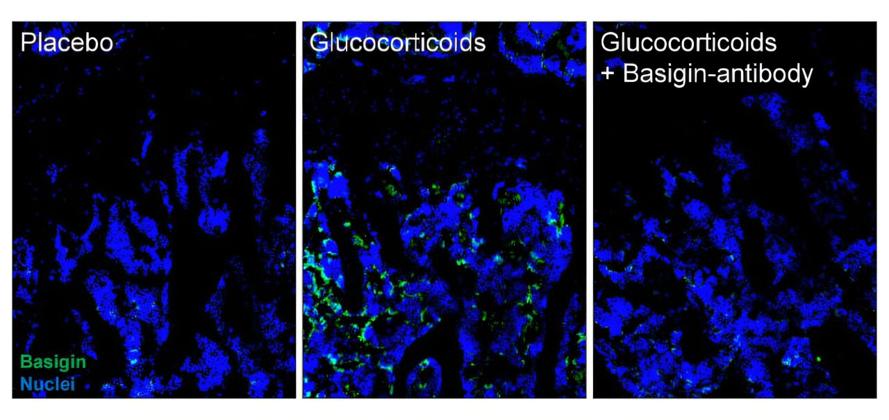 Les chercheurs découvrent une protéine clé et une stratégie prometteuse pour prévenir les dommages osseux des stéroïdes