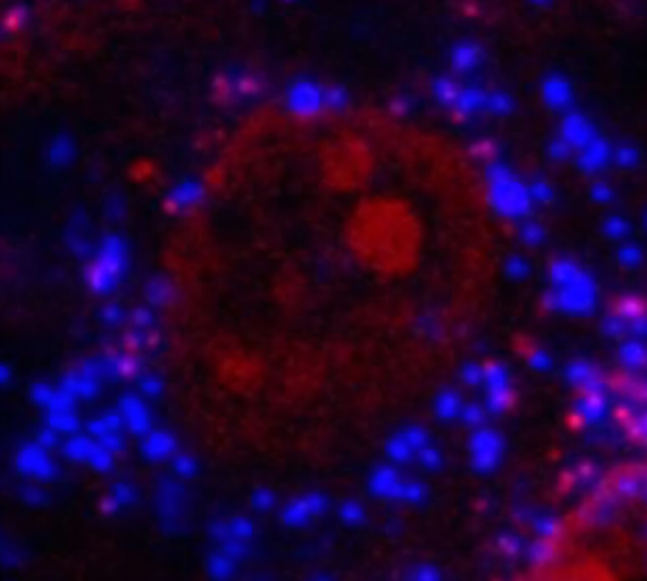 Microplastiques liés à une altération de la santé des os