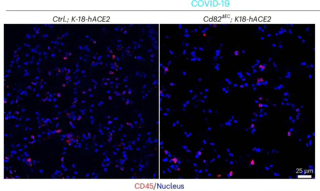 La protéine CD82 peut maintenir la clé de l'arrêt des fuites mortelles des vaisseaux sanguins dans une défaillance multi-organes