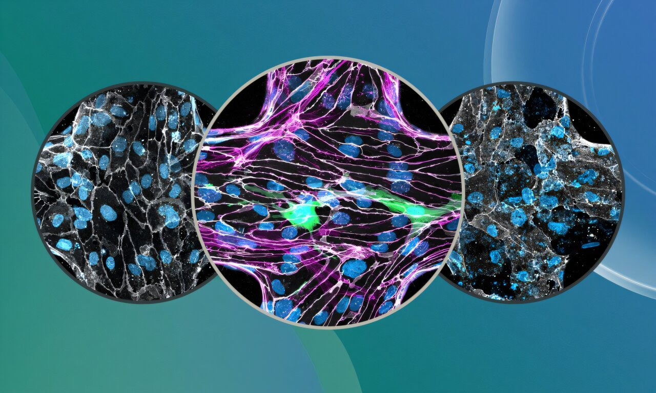 Une nouvelle étude montre comment le parasite ouvre la voie au cerveau