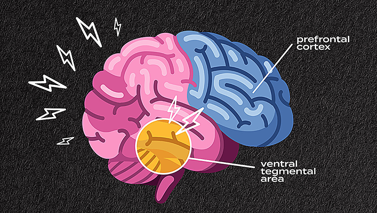 Des dommages neurologiques durables causés par un stress répété peuvent expliquer les schémas de risque de dépendance