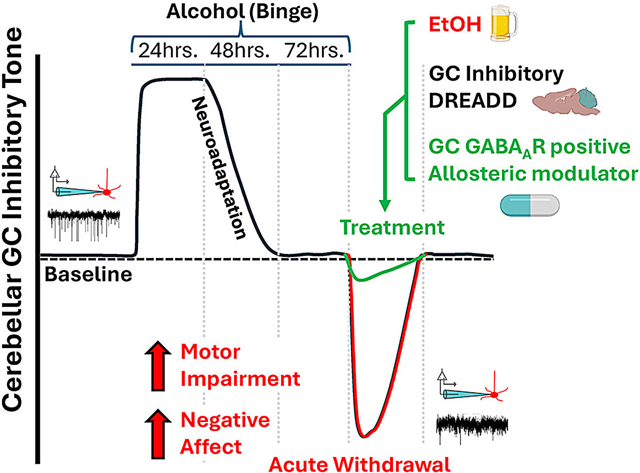 La modification d'une zone du cerveau pourrait débarrasser des symptômes de sevrage de l'alcool, les résultats de l'étude