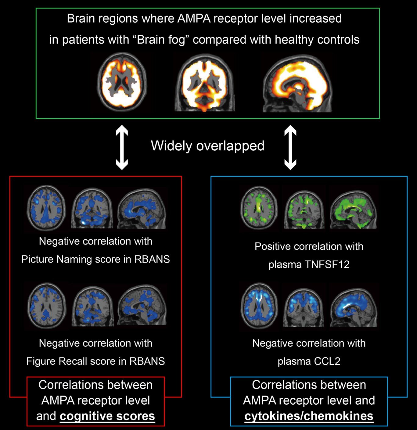 Découvrir la base moléculaire du brouillard cérébral à long terme