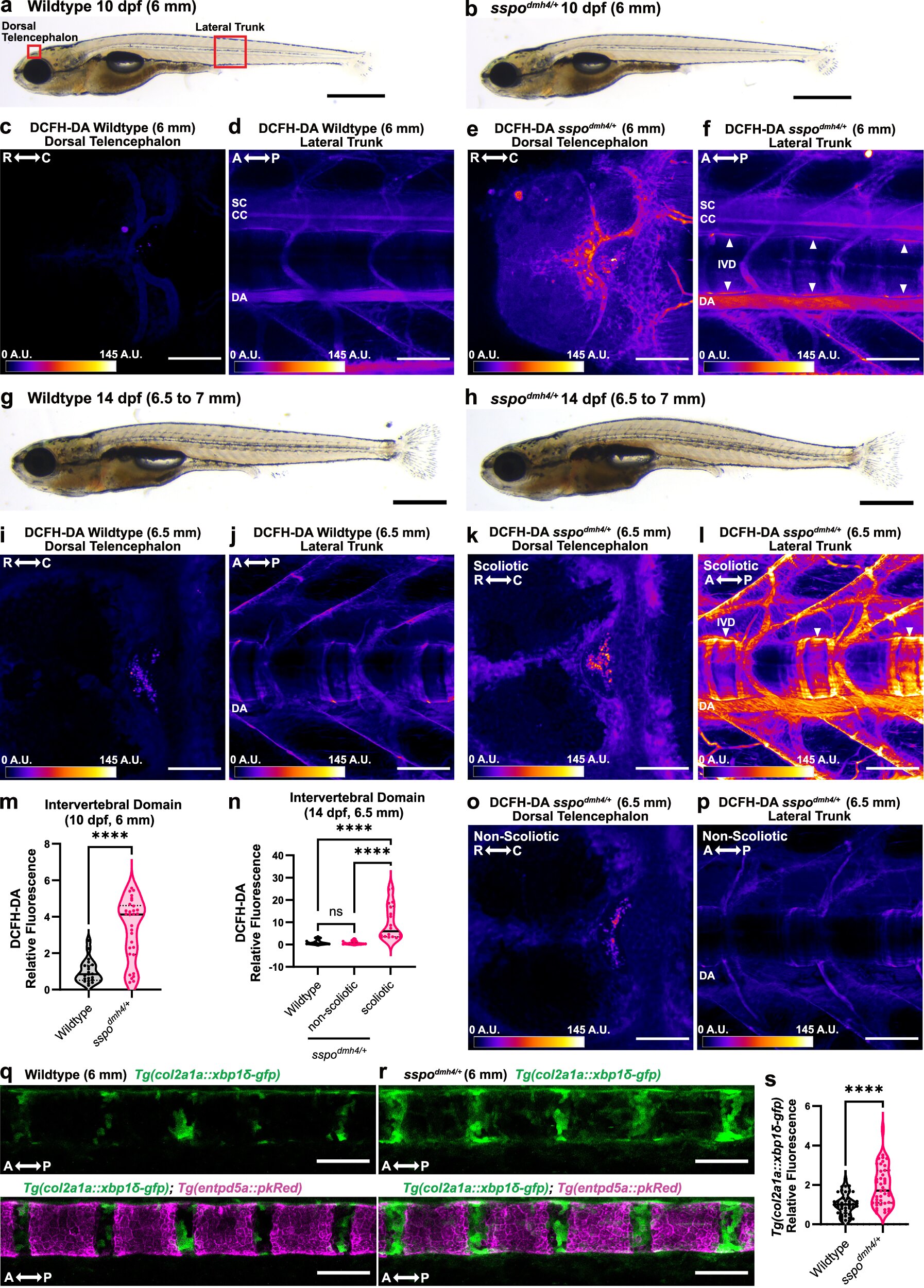 Les études de la colonne vertébrale du poisson zèbre révèlent de nouveaux indices sur la détection précoce de la scoliose