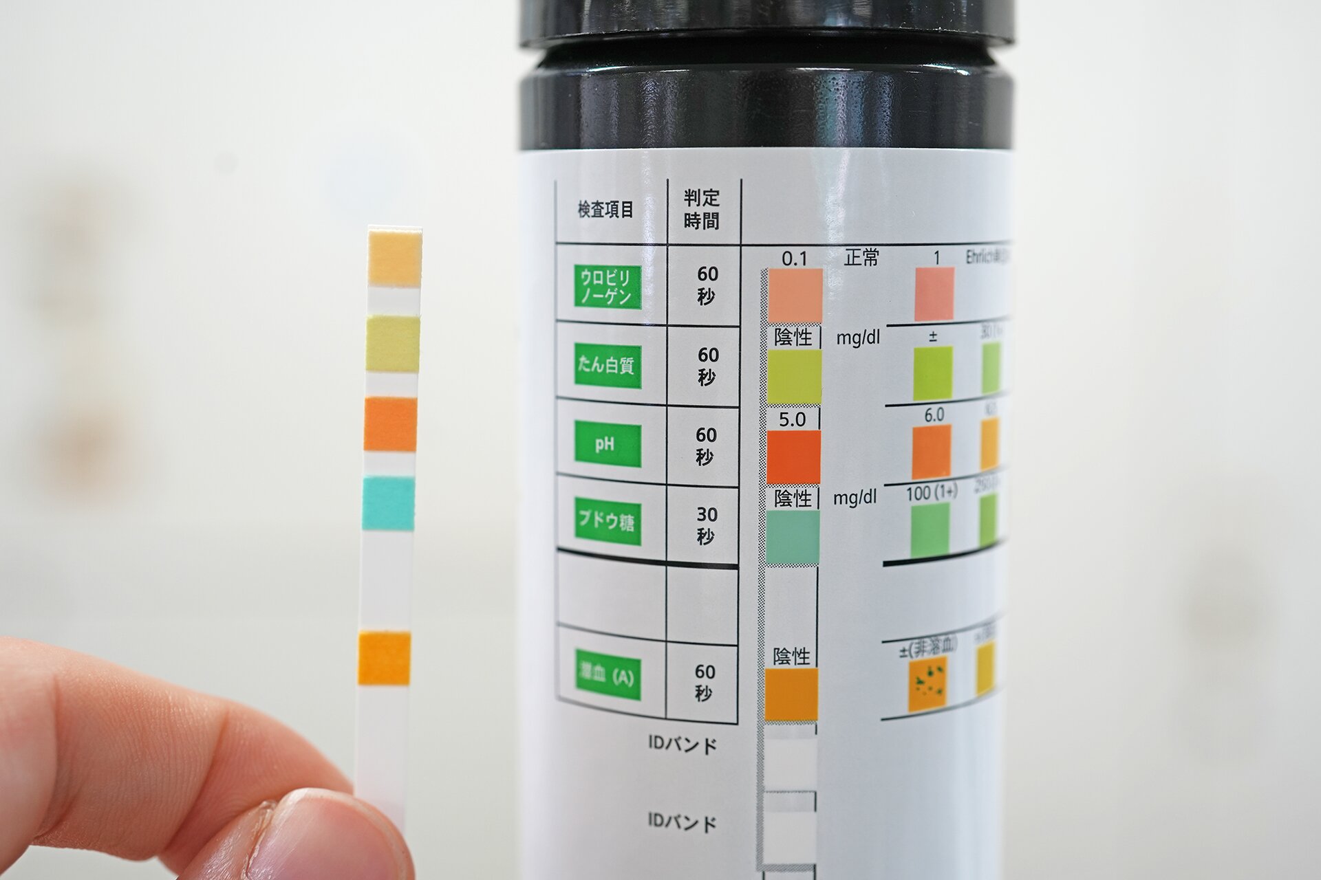 Détection du syndrome d'Alport par le biais d'un dépistage d'urine universel de 3 ans